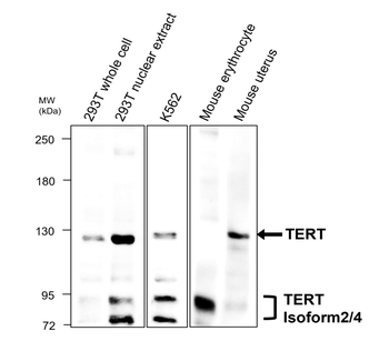 TERT (TRB doamain) Rabbit Polyclonal Antibody