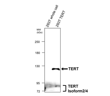 TERT (TRB doamain) Rabbit Polyclonal Antibody