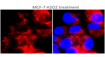 TERT (TRB doamain) Rabbit Polyclonal Antibody