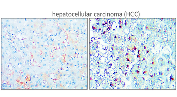 TERT (TRB doamain) Rabbit Polyclonal Antibody