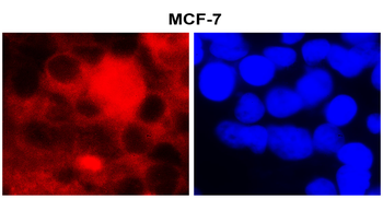 Fatty Acid Synthase/FASN Antibody