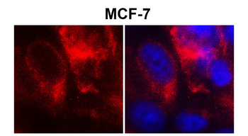 Claudin-1/CLDN1 Antibody