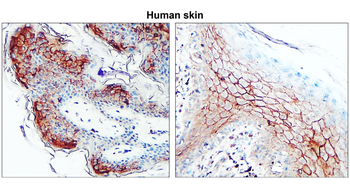 Claudin-1/CLDN1 Antibody