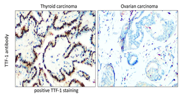 TTF-1/NKX2-1/Thyroid Transcription Factor Antibody