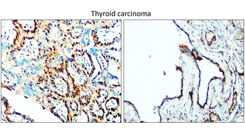 TTF-1/NKX2-1/Thyroid Transcription Factor Antibody