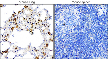 TTF-1/NKX2-1/Thyroid Transcription Factor Antibody