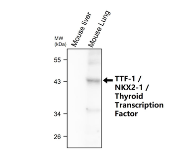 TTF-1/NKX2-1/Thyroid Transcription Factor Antibody