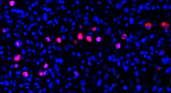 Ki67 [SP6] Rab-monoclonal Antibody