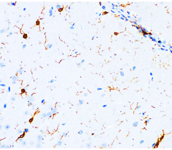 Iba1 Mouse Monoclonal Antibody