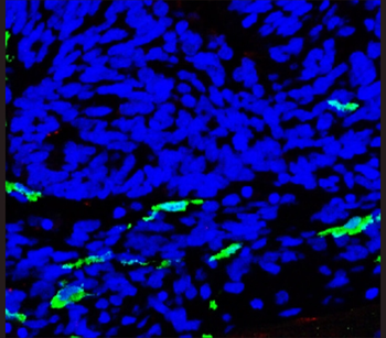 Iba1 Mouse Monoclonal Antibody