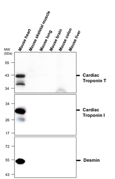 Desmin Mouse Monoclonal Antibody