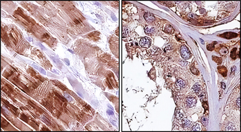 FNDC5 Rabbit Polyclonal Antibody