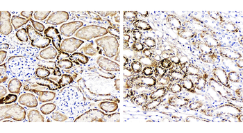 FNDC5 Rabbit Polyclonal Antibody