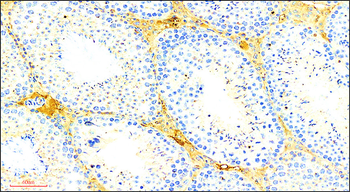 Occludin Rabbit Polyclonal Antibody