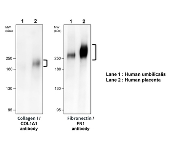 Fibronectin 1 Rabbit Polyclonal Antibody