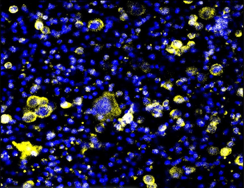 Fibronectin 1 Rabbit Polyclonal Antibody