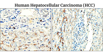 Fibronectin 1 Rabbit Polyclonal Antibody