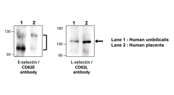 E-selectin | CD62E Rabbit Polyclonal Antibody
