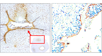 E-selectin | CD62E Rabbit Polyclonal Antibody