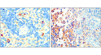 P-selectin | CD62P Rabbit Polyclonal Antibody