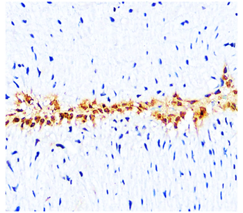 L-selectin | CD62L Antibody
