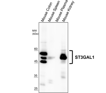 ST3GAL1 Rabbit Polyclonal Antibody