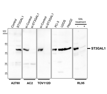 ST3GAL1 Rabbit Polyclonal Antibody