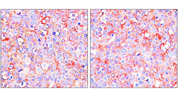 ST3GAL1 Rabbit Polyclonal Antibody