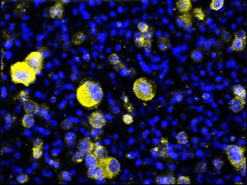 Tissue Factor/CD142 extracellular Antibody