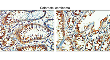Tissue Factor/CD142 extracellular Antibody