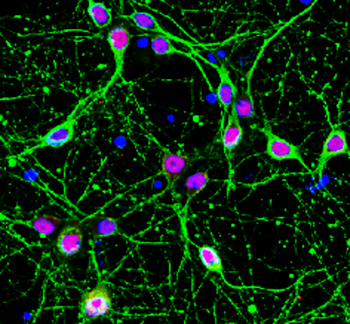 NeuN Rabbit Polyclonal Antibody