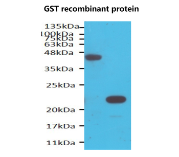 GST tag Mouse Monoclonal Antibody