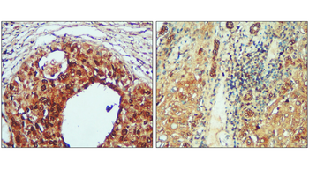 Toll-like Receptor 4 Rabbit Polyclonal Antibody