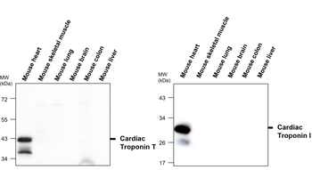 Troponin I Rabbit Polyclonal Antibody