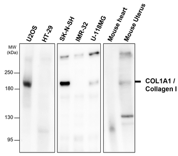 COL1A1/Collagen I Antibody