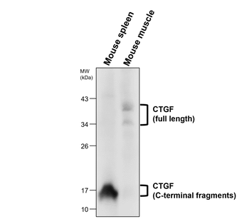 CTGF Antibody