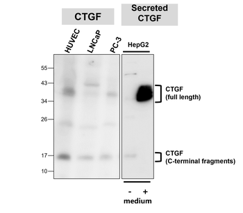 CTGF Antibody