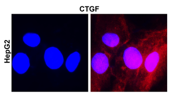 CTGF Antibody