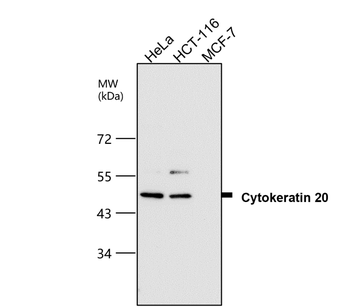 Cytokeratin 20, CK20 Antibody