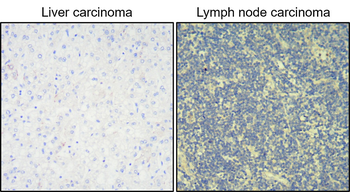 Cytokeratin 20, CK20 Antibody