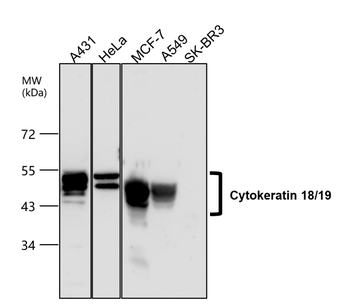 Cytokeratin 18/19, CK18/19 Antibody