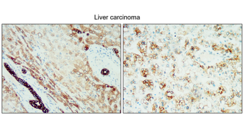 Cytokeratin 18/19, CK18/19 Antibody