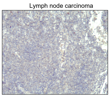 Cytokeratin 14 Rabbit Polyclonal Antibody