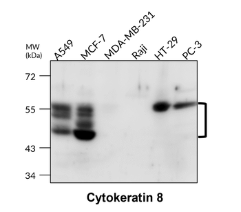 Cytokeratin 8 Rabbit Polyclonal Antibody