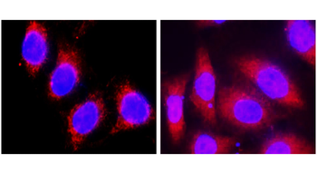 Cytokeratin 8 Rabbit Polyclonal Antibody