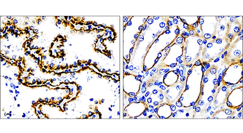 Cytokeratin 7, CK7 Antibody