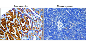 Pan-Cytokeratin, Pan-CK Antibody