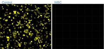 Pan-Cytokeratin, Pan-CK Antibody