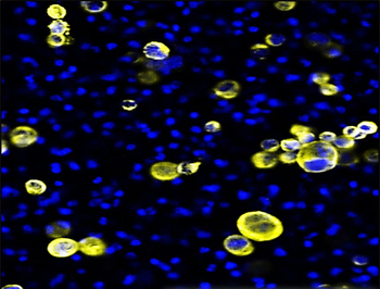 Pan-Cytokeratin, Pan-CK Antibody