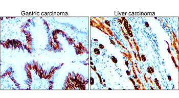 Pan-Cytokeratin, Pan-CK Antibody
